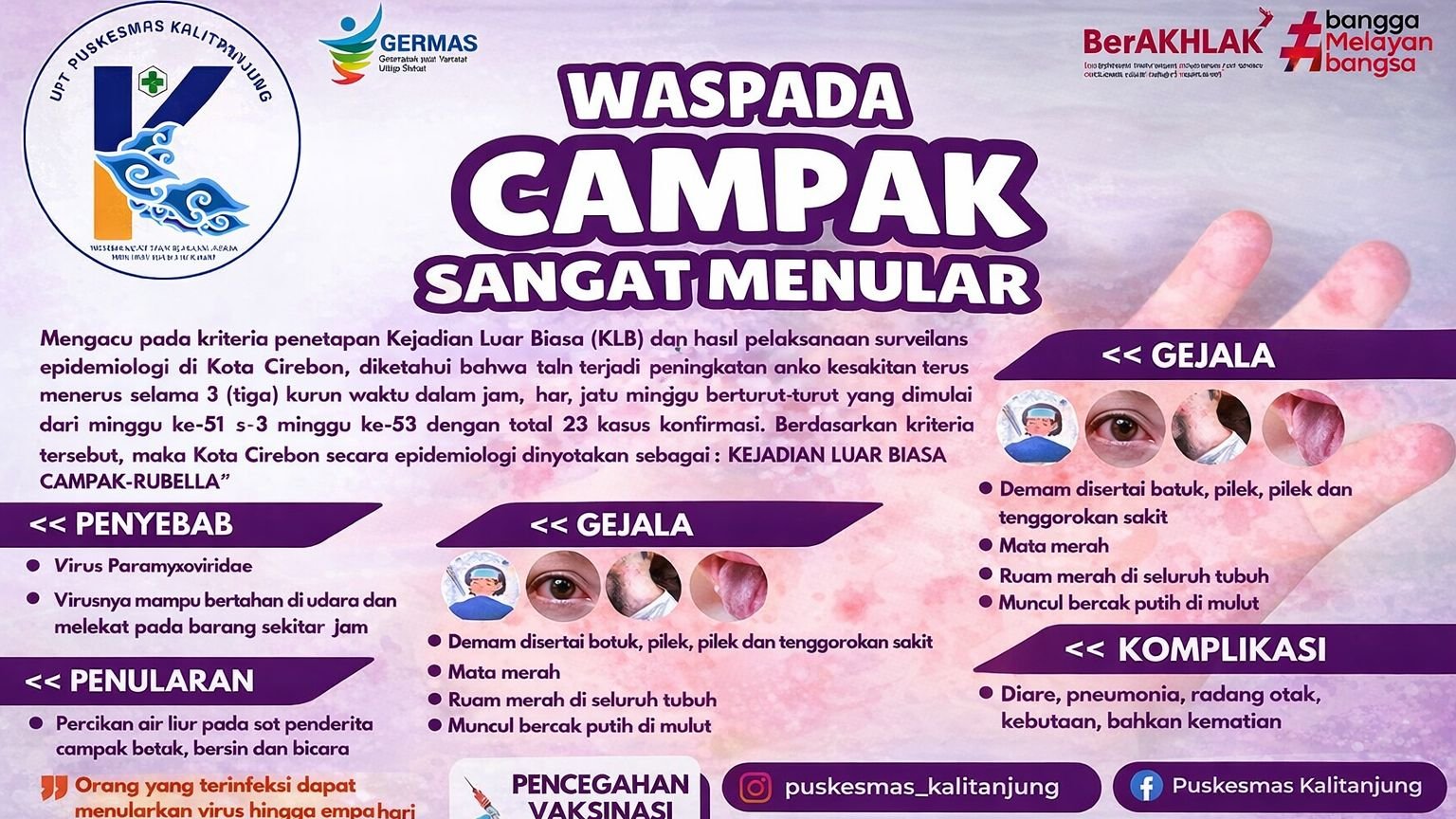 Waspada Campak, Penyakit Sangat Menular