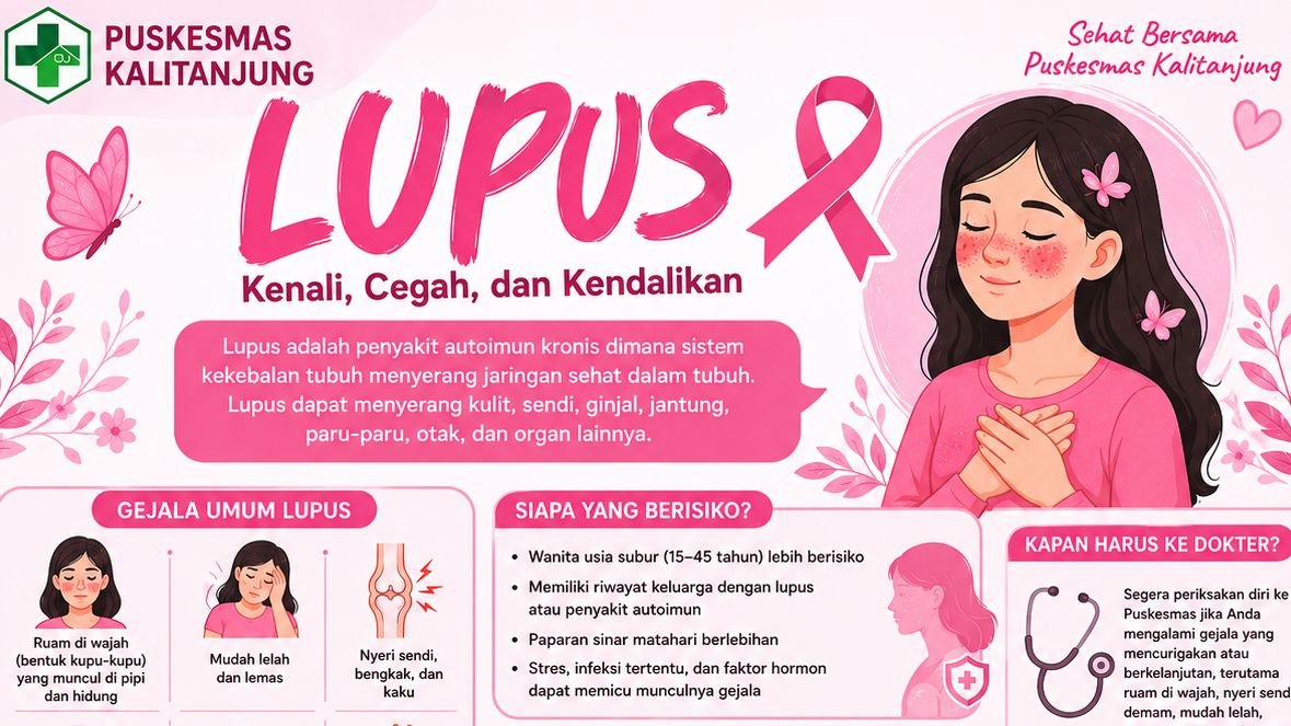 Kenali, Cegah, dan Kendalikan Lupus