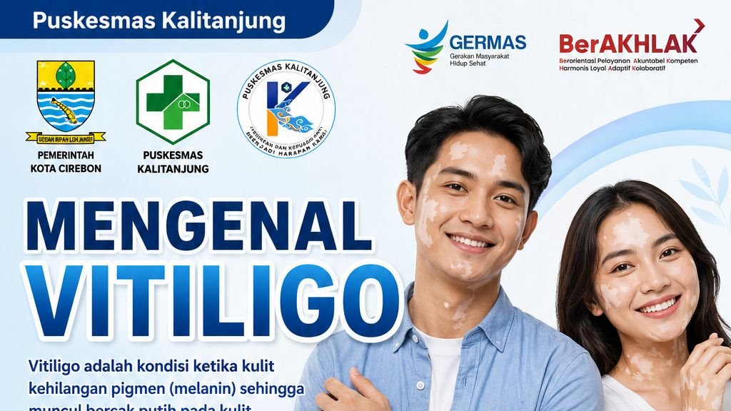 Mengenal Vitiligo: Kondisi Kulit yang Tidak Menular dan Perlu Dipahami