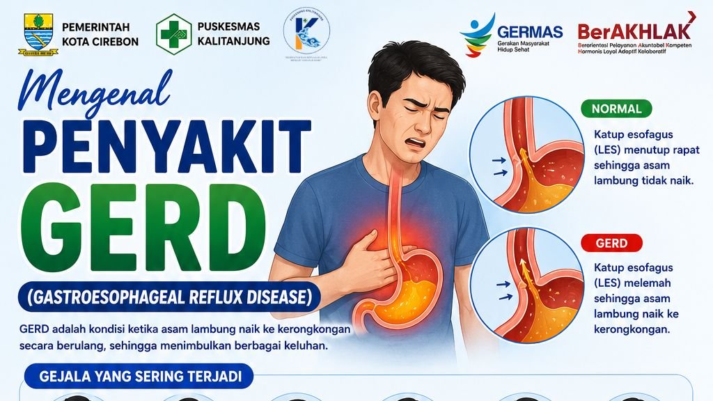 Sering Merasa Dada Panas, Asam di Mulut, atau Mual Setelah Makan. Waspadai GERD